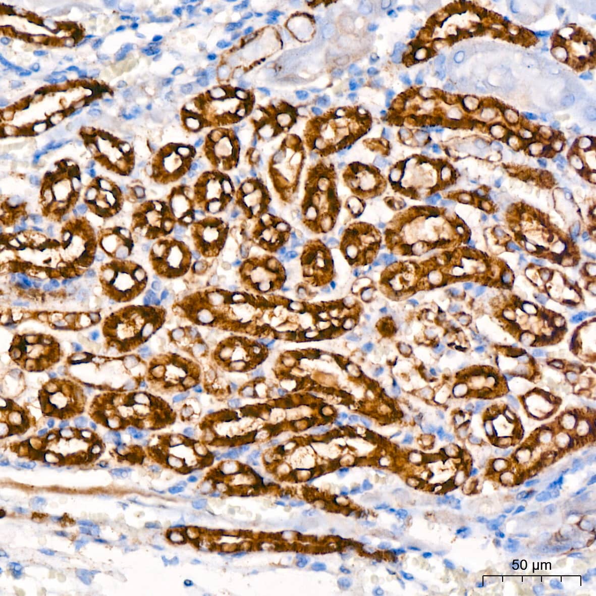 Immunohistochemistry: Hexokinase 1 Antibody (6B7Q2) [Hexokinase 1] - Immunohistochemistry analysis of paraffin-embedded Mouse kidney tissue using [KO Validated] Hexokinase 1 Rabbit mAb  at dilution of 1:200 (40x lens). High pressure antigen retrieval performed with 0.01M Citrate Bufferr (pH 6.0) prior to IHC staining.