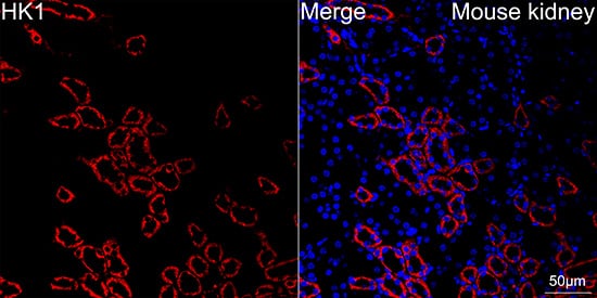 Immunocytochemistry/ Immunofluorescence: Hexokinase 1 Antibody (6B7Q2) [Hexokinase 1] - Confocal imaging of paraffin-embedded Mouse kidney tissue using [KO Validated] Hexokinase 1 Rabbit mAb  followed by a further incubation with Cy3 Goat Anti-Rabbit IgG (H+L)  . DAPI was used for nuclear staining (Blue). Objective: 40x.Perform high pressure antigen retrieval with 0.01M citrate buffer (pH 6.0) prior to IF staining.