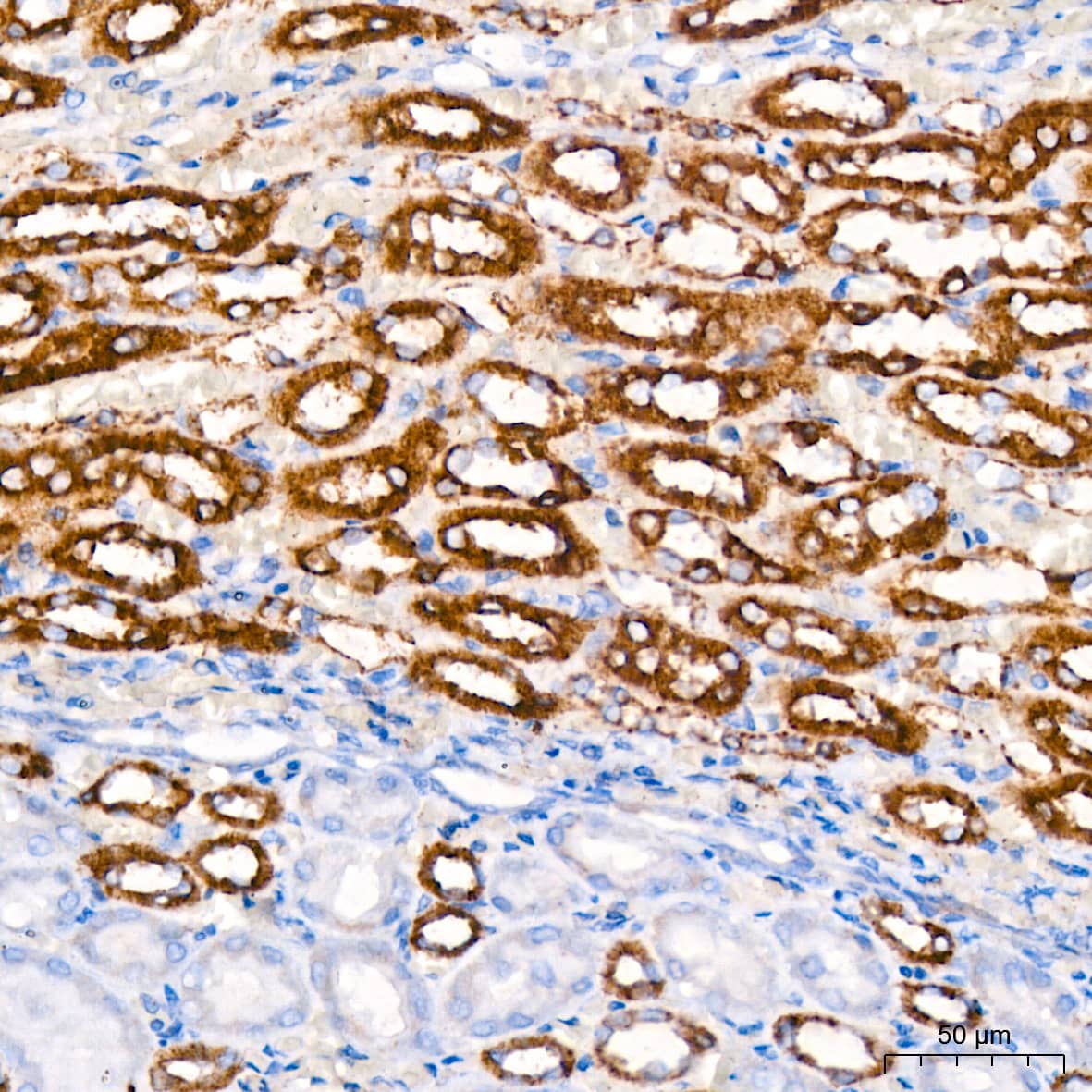 Immunohistochemistry: Hexokinase 1 Antibody (6B7Q2) [Hexokinase 1] - Immunohistochemistry analysis of paraffin-embedded Rat kidney tissue using [KO Validated] Hexokinase 1 Rabbit mAb  at dilution of 1:200 (40x lens). High pressure antigen retrieval performed with 0.01M Citrate Bufferr (pH 6.0) prior to IHC staining.