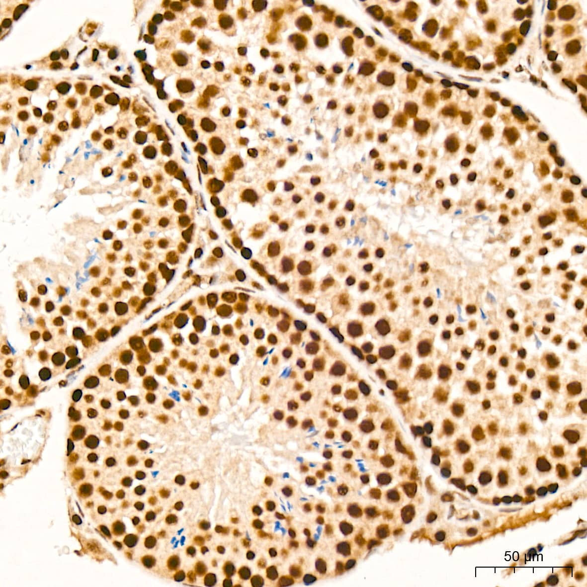 Immunohistochemistry: RAP30 Antibody (3T7Q9) [NBP3-15275] - Immunohistochemistry analysis of RAP30 in paraffin-embedded mouse testis tissue using RAP30 Rabbit mAb  at a dilution of 1:200 (40x lens). High pressure antigen retrieval was performed with 0.01 M citrate buffer (pH 6.0) prior to IHC staining.