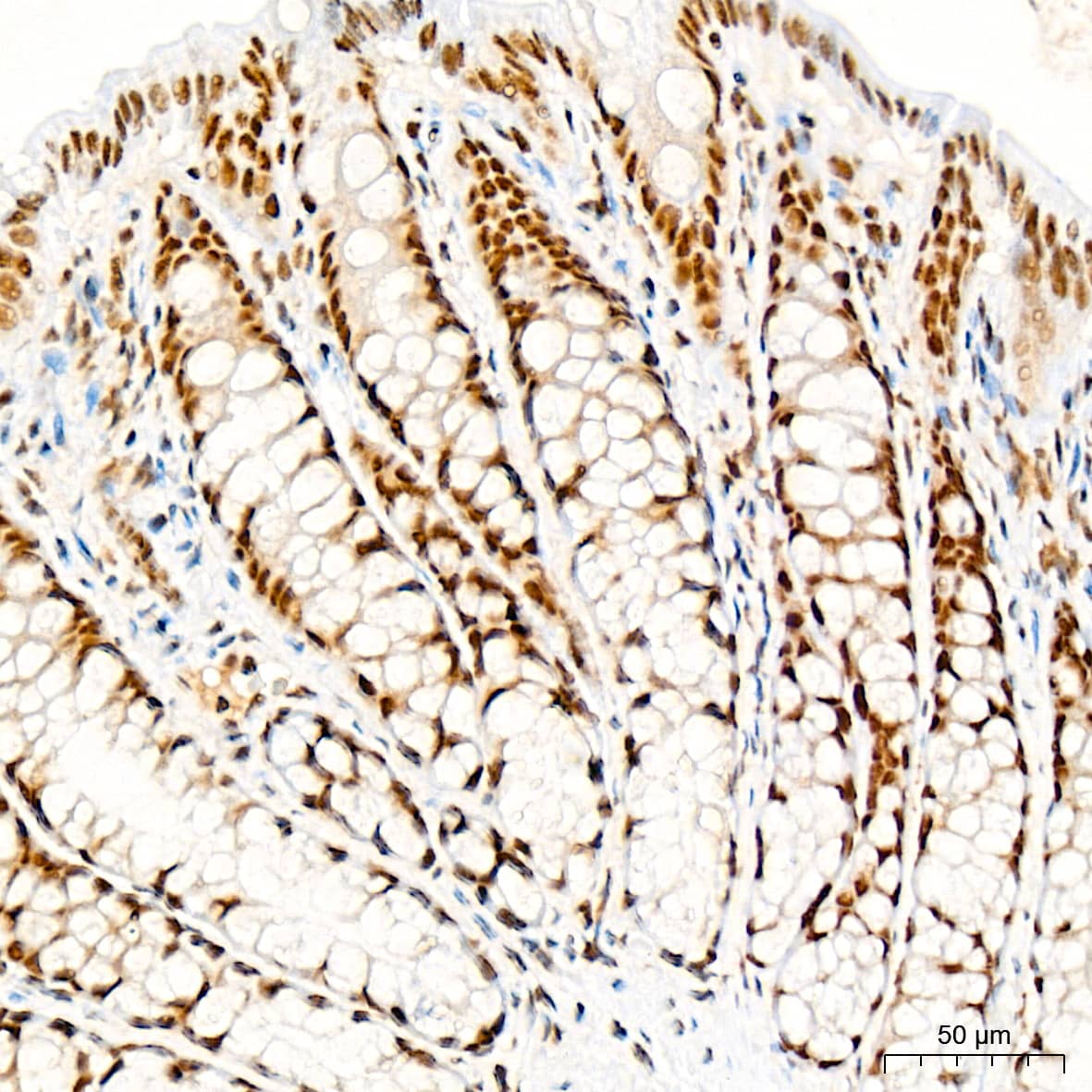 Immunohistochemistry: RAP30 Antibody (3T7Q9) [NBP3-15275] - Immunohistochemistry analysis of RAP30 in paraffin-embedded rat colon tissue using RAP30 Rabbit mAb  at a dilution of 1:200 (40x lens). High pressure antigen retrieval was performed with 0.01 M citrate buffer (pH 6.0) prior to IHC staining.