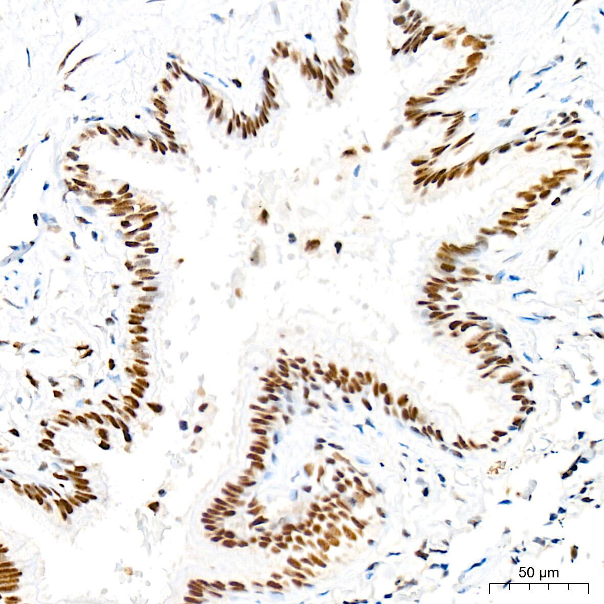 Immunohistochemistry: RAP30 Antibody (3T7Q9) [NBP3-15275] - Immunohistochemistry analysis of RAP30 in paraffin-embedded human lung tissue using RAP30 Rabbit mAb  at a dilution of 1:200 (40x lens). High pressure antigen retrieval was performed with 0.01 M citrate buffer (pH 6.0) prior to IHC staining.