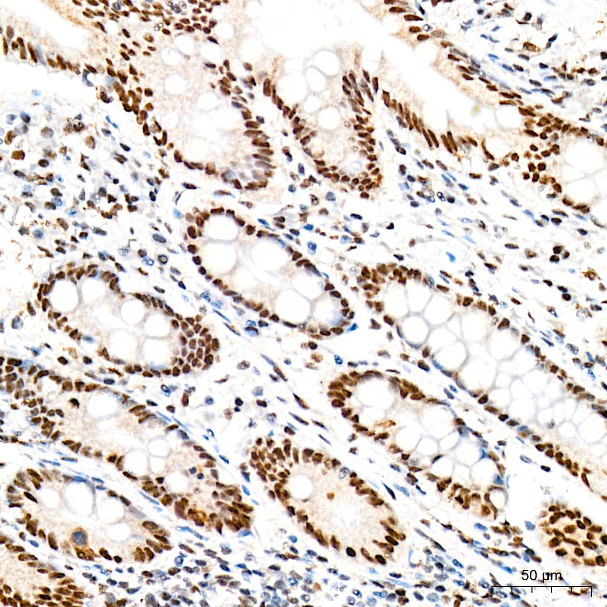 Immunohistochemistry: RAP30 Antibody (3T7Q9) [NBP3-15275] - Immunohistochemistry analysis of RAP30 in paraffin-embedded human colon tissue using RAP30 Rabbit mAb  at a dilution of 1:200 (40x lens). High pressure antigen retrieval was performed with 0.01 M citrate buffer (pH 6.0) prior to IHC staining.