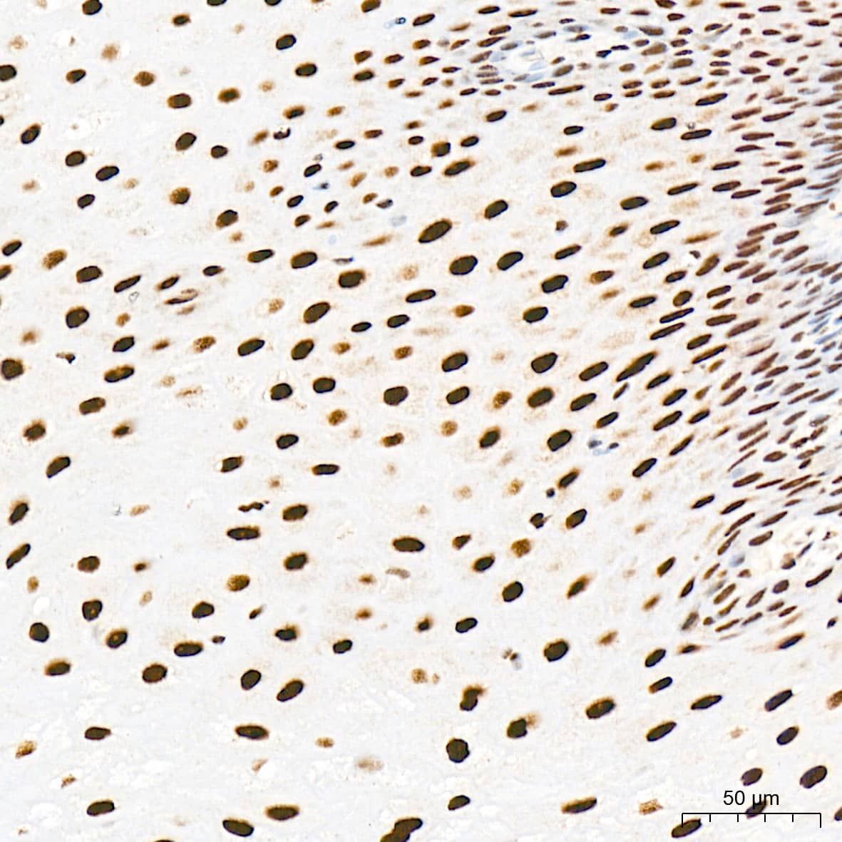 Immunohistochemistry: RAP30 Antibody (3T7Q9) [NBP3-15275] - Immunohistochemistry analysis of RAP30 in paraffin-embedded human esophagus tissue using RAP30 Rabbit mAb  at a dilution of 1:200 (40x lens). High pressure antigen retrieval was performed with 0.01 M citrate buffer (pH 6.0) prior to IHC staining.