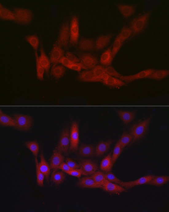 Immunocytochemistry/ Immunofluorescence: PGD Antibody (9A2M7) [PGD] - Immunofluorescence analysis of PC-12 cells using PGD Rabbit mAb  at dilution of 1:100 (40x lens). Secondary antibody: Cy3 Goat Anti-Rabbit IgG (H+L)  at 1:500 dilution. Blue: DAPI for nuclear staining.