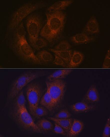 Immunocytochemistry/ Immunofluorescence: PUM1 Antibody (8Y6H5) [NBP3-15279] - Immunofluorescence analysis of U-2 OS cells using PUM1 Rabbit mAb  at dilution of 1:100 (40x lens). Blue: DAPI for nuclear staining.
