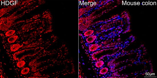 Immunocytochemistry/ Immunofluorescence: HDGF Antibody (5U7A7) [NBP3-15281] - Confocal imaging of paraffin-embedded Mouse colon tissue using HDGF Rabbit mAb  followed by a further incubation with Cy3 Goat Anti-Rabbit IgG (H+L)  . DAPI was used for nuclear staining (Blue). Objective: 40x. Perform high pressure antigen retrieval with 0.01 M citrate buffer (pH 6.0) prior to IF staining.