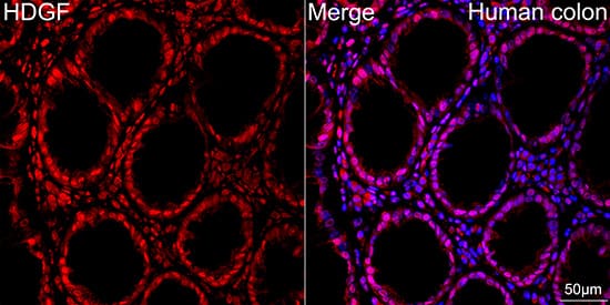 Immunocytochemistry/ Immunofluorescence: HDGF Antibody (5U7A7) [NBP3-15281] - Confocal imaging of paraffin-embedded Human colon tissue using HDGF Rabbit mAb  followed by a further incubation with Cy3 Goat Anti-Rabbit IgG (H+L)  . DAPI was used for nuclear staining (Blue). Objective: 40x. Perform high pressure antigen retrieval with 0.01 M citrate buffer (pH 6.0) prior to IF staining.