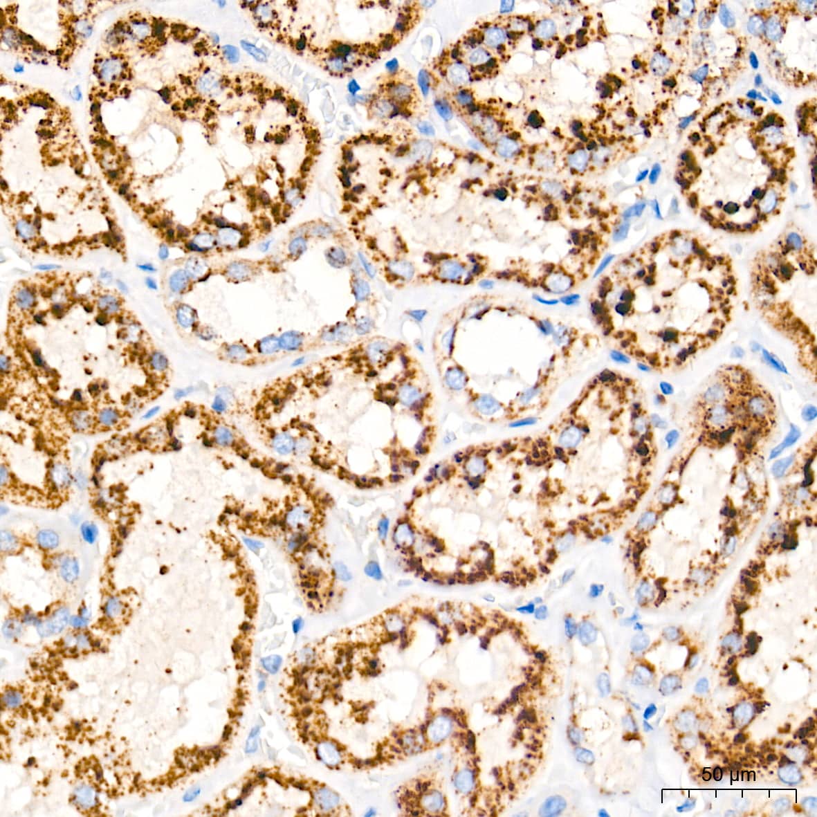 Immunohistochemistry: LAMP-2/CD107b Antibody (5N8J3) [LAMP-2/CD107b] - Immunohistochemistry analysis of paraffin-embedded Human kidney tissue using LAMP-2/CD107b Rabbit mAb  at a dilution of 1:2000 (40x lens). High pressure antigen retrieval performed with 0.01M Tris-EDTA Buffer (pH 9.0) prior to IHC staining.