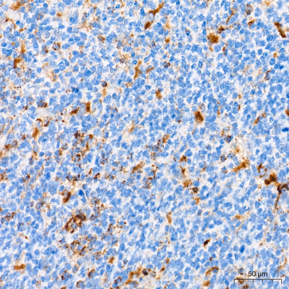 Immunohistochemistry: LAMP-2/CD107b Antibody (5N8J3) [LAMP-2/CD107b] - Immunohistochemistry analysis of paraffin-embedded Human tonsil tissue using LAMP-2/CD107b Rabbit mAb  at a dilution of 1:2000 (40x lens). High pressure antigen retrieval performed with 0.01M Tris-EDTA Buffer (pH 9.0) prior to IHC staining.