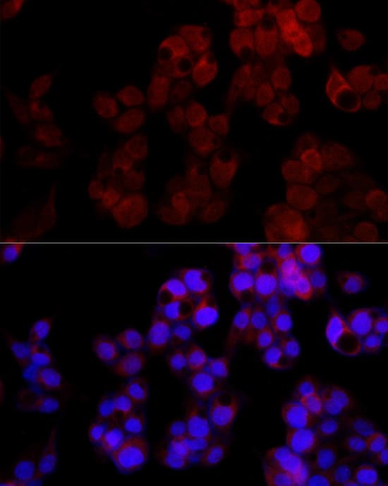 Immunocytochemistry/ Immunofluorescence: ADP-Sugar Pyrophosphatase/NUDT5 Antibody (7Y9M2) [NBP3-15284] - Immunofluorescence analysis of HepG2 cells using ADP-Sugar Pyrophosphatase/NUDT5 Rabbit mAb  at dilution of 1:100 (40x lens). Blue: DAPI for nuclear staining.