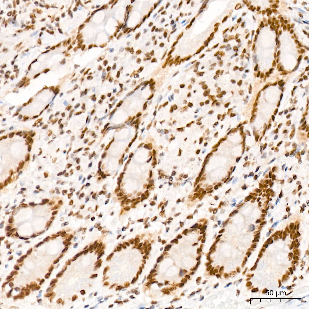 Immunohistochemistry: MED4 Antibody (8T5C9) [NBP3-15287] - Immunohistochemistry analysis of MED4 in paraffin-embedded human colon tissue using MED4 Rabbit mAb  at a dilution of 1:200 (40x lens). High pressure antigen retrieval was performed with 0.01 M citrate buffer (pH 6.0) prior to IHC staining.