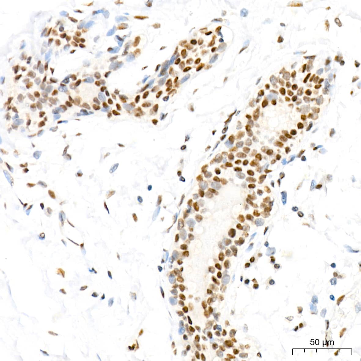 Immunohistochemistry: MED4 Antibody (8T5C9) [NBP3-15287] - Immunohistochemistry analysis of MED4 in paraffin-embedded human breast tissue using MED4 Rabbit mAb  at a dilution of 1:200 (40x lens). High pressure antigen retrieval was performed with 0.01 M citrate buffer (pH 6.0) prior to IHC staining.