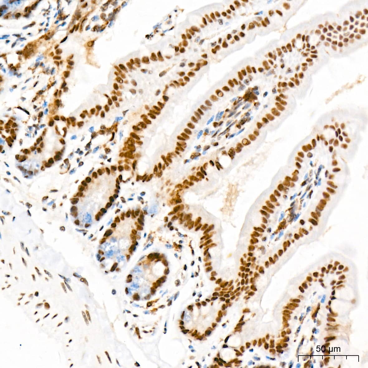 Immunohistochemistry: MED4 Antibody (8T5C9) [NBP3-15287] - Immunohistochemistry analysis of MED4 in paraffin-embedded rat colon tissue using MED4 Rabbit mAb  at a dilution of 1:200 (40x lens). High pressure antigen retrieval was performed with 0.01 M citrate buffer (pH 6.0) prior to IHC staining.