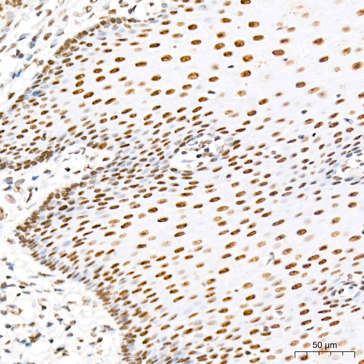 Immunohistochemistry: MED4 Antibody (8T5C9) [NBP3-15287] - Immunohistochemistry analysis of MED4 in paraffin-embedded human esophagus tissue using MED4 Rabbit mAb  at a dilution of 1:200 (40x lens). High pressure antigen retrieval was performed with 0.01 M citrate buffer (pH 6.0) prior to IHC staining.