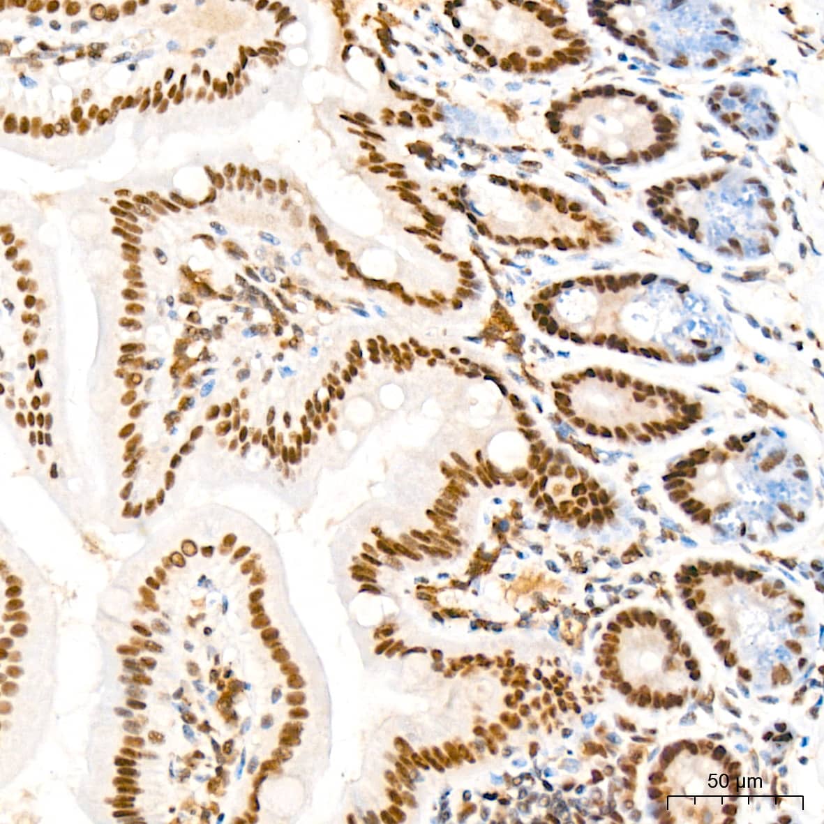 Immunohistochemistry: MED4 Antibody (8T5C9) [NBP3-15287] - Immunohistochemistry analysis of MED4 in paraffin-embedded mouse colon tissue using MED4 Rabbit mAb  at a dilution of 1:200 (40x lens). High pressure antigen retrieval was performed with 0.01 M citrate buffer (pH 6.0) prior to IHC staining.