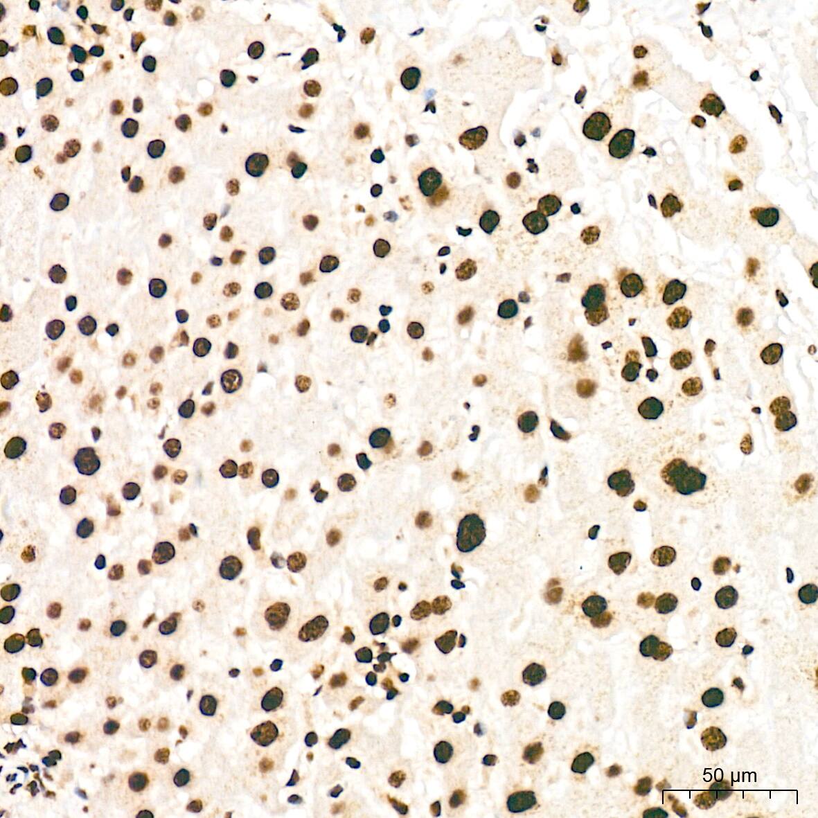 Immunohistochemistry: SNRPA1 Antibody (2D7M1) [NBP3-15292] - Immunohistochemistry analysis of SNRPA1 in paraffin-embedded human liver tissue using SNRPA1 Rabbit mAb  at a dilution of 1:200 (40x lens). High pressure antigen retrieval was performed with 0.01 M citrate buffer (pH 6.0) prior to IHC staining.
