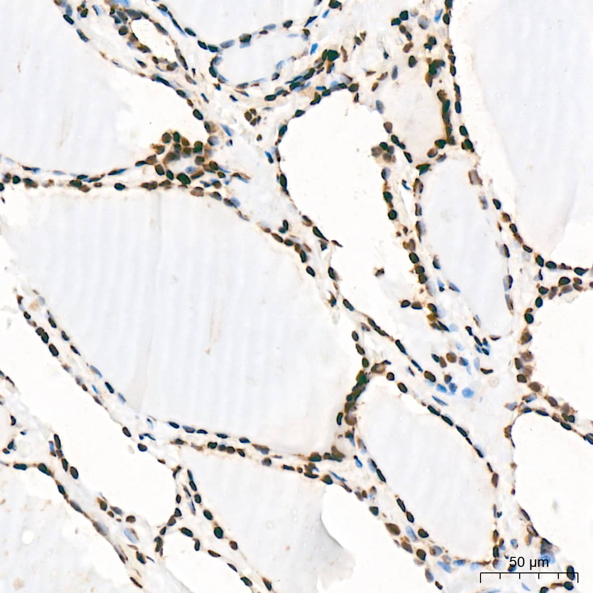 Immunohistochemistry: SNRPA1 Antibody (2D7M1) [NBP3-15292] - Immunohistochemistry analysis of SNRPA1 in paraffin-embedded human thyroid tissue using SNRPA1 Rabbit mAb  at a dilution of 1:200 (40x lens). High pressure antigen retrieval was performed with 0.01 M citrate buffer (pH 6.0) prior to IHC staining.