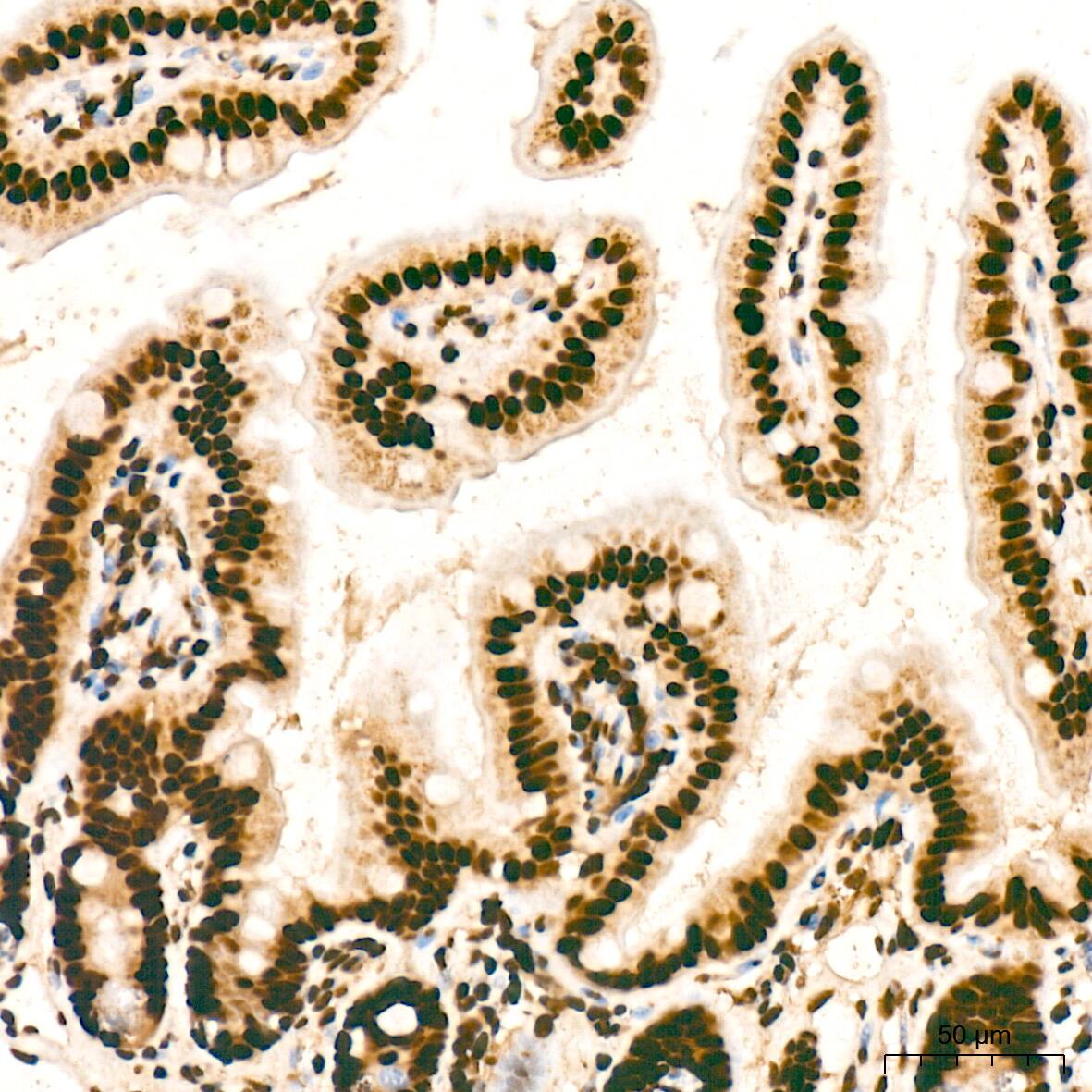 Immunohistochemistry: SNRPA1 Antibody (2D7M1) [NBP3-15292] - Immunohistochemistry analysis of SNRPA1 in paraffin-embedded rat intestine tissue using SNRPA1 Rabbit mAb  at a dilution of 1:200 (40x lens). High pressure antigen retrieval was performed with 0.01 M citrate buffer (pH 6.0) prior to IHC staining.