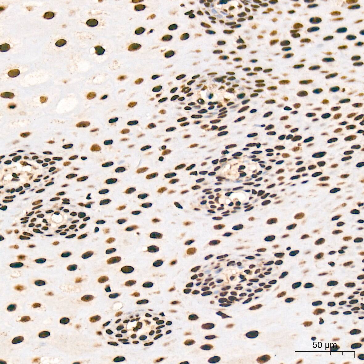 Immunohistochemistry: SNRPA1 Antibody (2D7M1) [NBP3-15292] - Immunohistochemistry analysis of SNRPA1 in paraffin-embedded human esophagus tissue using SNRPA1 Rabbit mAb  at a dilution of 1:200 (40x lens). High pressure antigen retrieval was performed with 0.01 M citrate buffer (pH 6.0) prior to IHC staining.