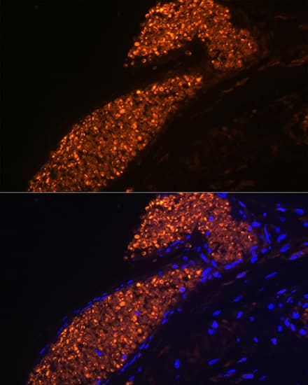 Immunocytochemistry/ Immunofluorescence: HBG1 Antibody (1R9T7) [HBG1] - Immunofluorescence analysis of paraffin-embedded human placenta using HBG1 Rabbit mAb  at dilution of 1:100 (40x lens). Secondary antibody: Cy3-conjugated Goat anti-Rabbit IgG (H+L)  at 1:500 dilution. Blue: DAPI for nuclear staining.