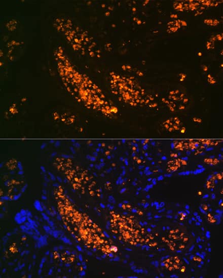 Immunocytochemistry/ Immunofluorescence: HBG1 Antibody (6F1A8) [HBG1] - Immunofluorescence analysis of paraffin-embedded human placenta using HBG1 Rabbit mAb  at dilution of 1:100 (40x lens). Secondary antibody: Cy3 Goat Anti-Rabbit IgG (H+L)  at 1:500 dilution. Blue: DAPI for nuclear staining.