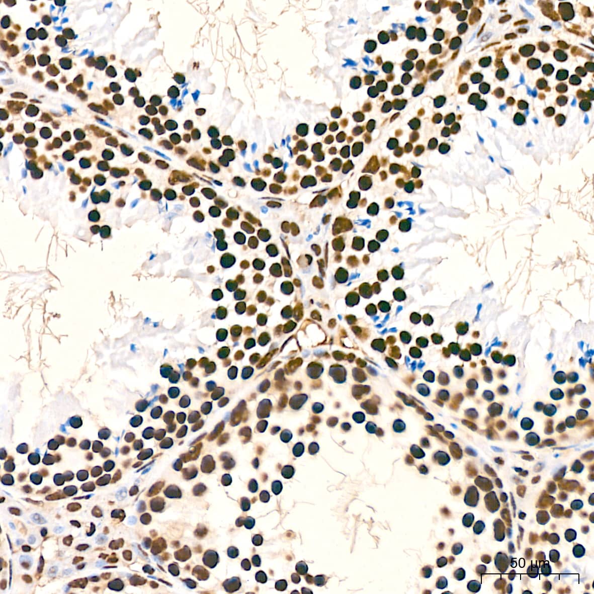 Immunohistochemistry: hnRNP K Antibody (3O5Y4) [NBP3-15303] - Immunohistochemistry analysis of hnRNP K in paraffin-embedded mouse testis tissue using hnRNP K Rabbit mAb  at a dilution of 1:800 (40x lens).High pressure antigen retrieval was performed with 0.01 M citrate buffer (pH 6.0) prior to IHC staining.