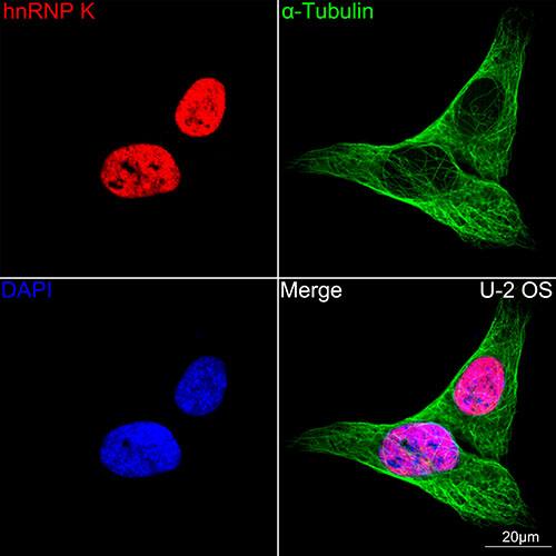Immunocytochemistry/ Immunofluorescence: hnRNP K Antibody (3O5Y4) [NBP3-15303] - Confocal imaging of U-2 0S cells using hnRNP K Rabbit mAb . The cells were counterstained with alpha-Tubulin Mouse mAb  (Green). DAPI was used for nuclear staining (blue). Objective: 60x.