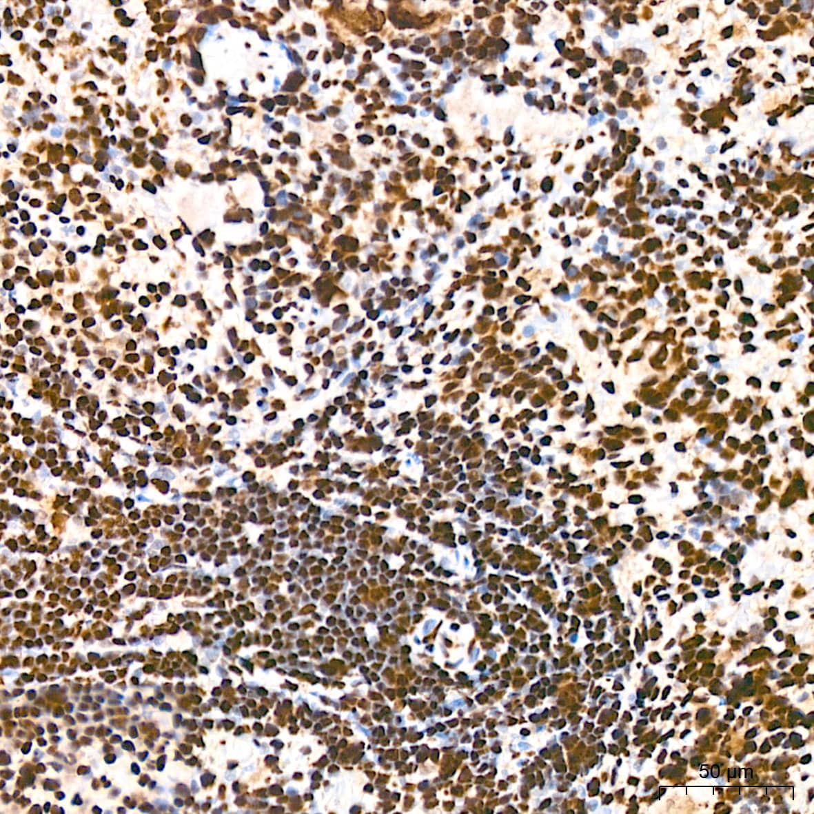 Immunohistochemistry: hnRNP K Antibody (3O5Y4) [NBP3-15303] - Immunohistochemistry analysis of hnRNP K in paraffin-embedded rat spleen tissue using hnRNP K Rabbit mAb  at a dilution of 1:800 (40x lens).High pressure antigen retrieval was performed with 0.01 M citrate buffer (pH 6.0) prior to IHC staining.