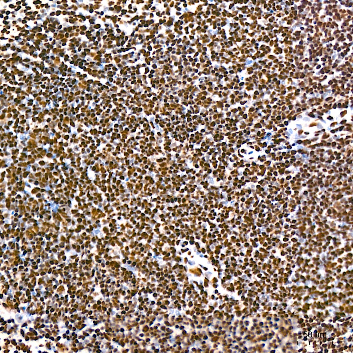 Immunohistochemistry: hnRNP K Antibody (3O5Y4) [NBP3-15303] - Immunohistochemistry analysis of hnRNP K in paraffin-embedded mouse spleen tissue using hnRNP K Rabbit mAb  at a dilution of 1:800 (40x lens).High pressure antigen retrieval was performed with 0.01 M citrate buffer (pH 6.0) prior to IHC staining.
