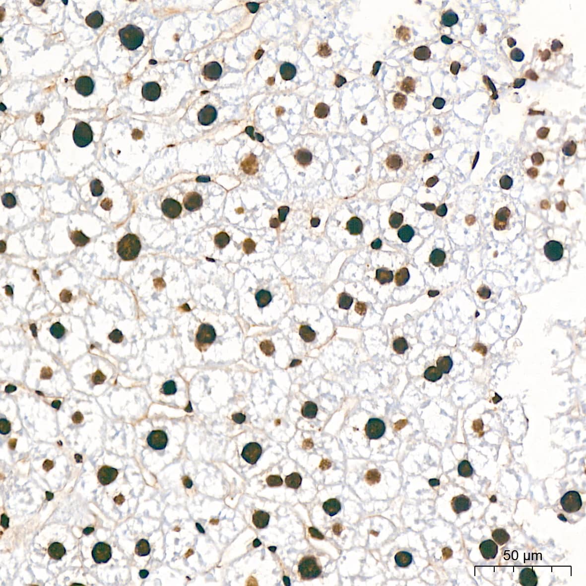 Immunohistochemistry: hnRNP K Antibody (3O5Y4) [NBP3-15303] - Immunohistochemistry analysis of hnRNP K in paraffin-embedded mouse liver tissue using hnRNP K Rabbit mAb  at a dilution of 1:800 (40x lens).High pressure antigen retrieval was performed with 0.01 M citrate buffer (pH 6.0) prior to IHC staining.