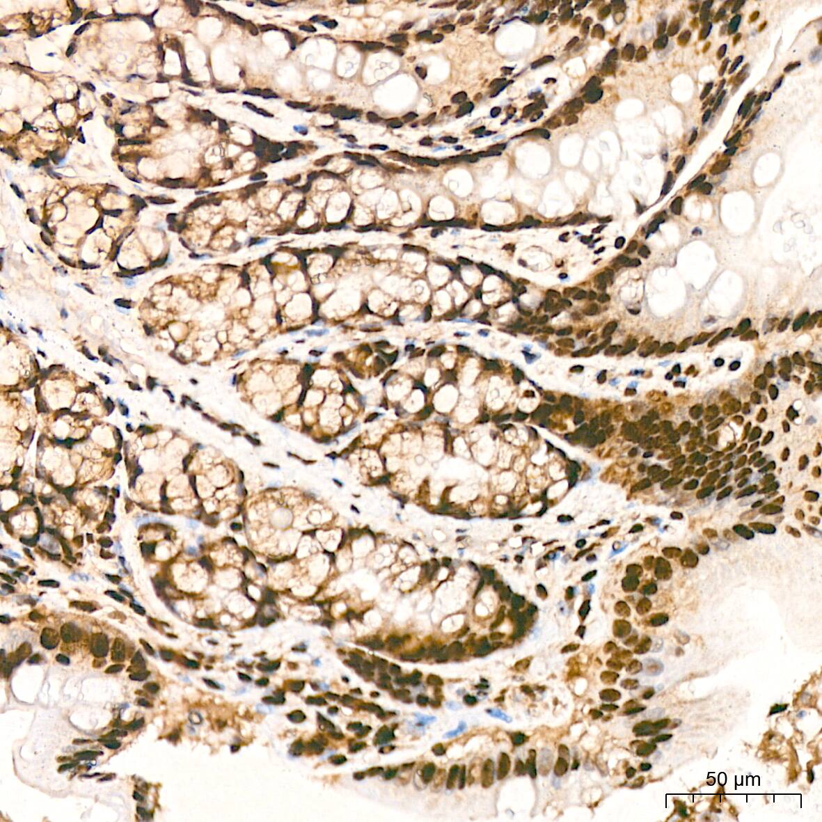 Immunohistochemistry: hnRNP K Antibody (3O5Y4) [NBP3-15303] - Immunohistochemistry analysis of hnRNP K in paraffin-embedded rat colon tissue using hnRNP K Rabbit mAb  at a dilution of 1:800 (40x lens).High pressure antigen retrieval was performed with 0.01 M citrate buffer (pH 6.0) prior to IHC staining.