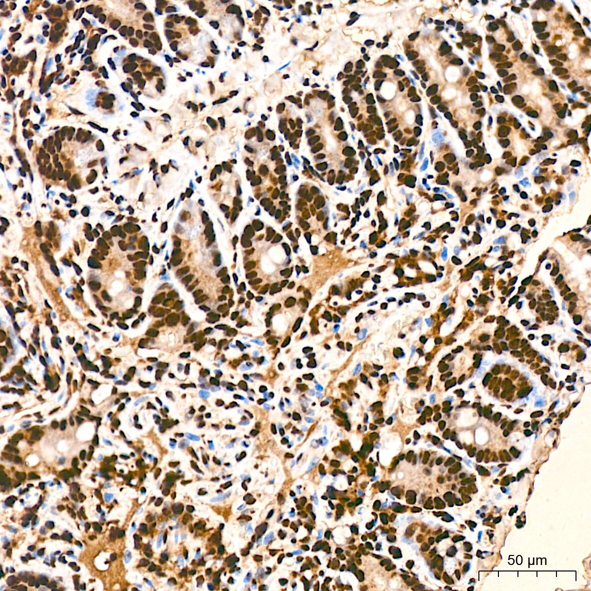 Immunohistochemistry: hnRNP K Antibody (3O5Y4) [NBP3-15303] - Immunohistochemistry analysis of hnRNP K in paraffin-embedded mouse colon tissue using hnRNP K Rabbit mAb  at a dilution of 1:800 (40x lens).High pressure antigen retrieval was performed with 0.01 M citrate buffer (pH 6.0) prior to IHC staining.