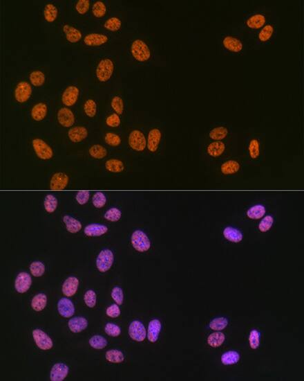 Immunocytochemistry/ Immunofluorescence: Matrin 3 Antibody (10O1D1) [Matrin 3] - Immunofluorescence analysis of U-2 OS cells using Matrin 3 Rabbit mAb  at dilution of 1:100 (40x lens). Secondary antibody: Cy3 Goat Anti-Rabbit IgG (H+L)  at 1:500 dilution. Blue: DAPI for nuclear staining.