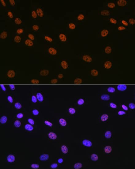 Immunocytochemistry/ Immunofluorescence: Matrin 3 Antibody (10O1D1) [Matrin 3] - Immunofluorescence analysis of NIH-3T3 cells using Matrin 3 Rabbit mAb  at dilution of 1:100 (40x lens). Secondary antibody: Cy3 Goat Anti-Rabbit IgG (H+L)  at 1:500 dilution. Blue: DAPI for nuclear staining.