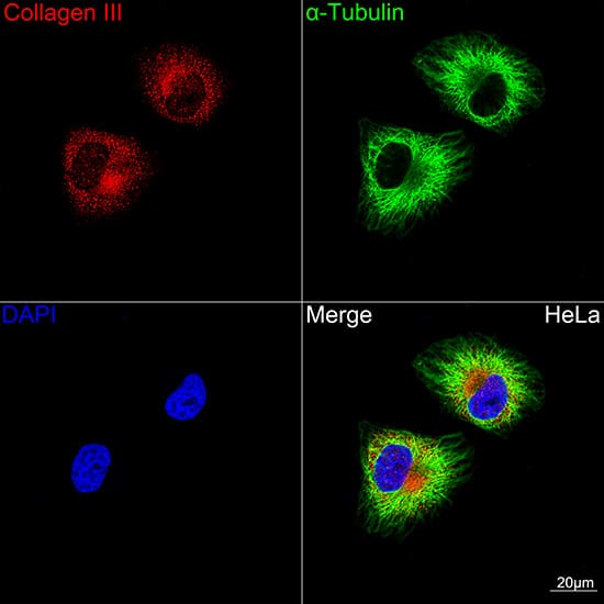 Immunocytochemistry/ Immunofluorescence: Collagen III alpha 1/COL3A1 Antibody (6Y9C6) [Collagen III alpha 1/COL3A1] - Confocal imaging of HeLa cells using Collagen III alpha 1/COL3A1 Rabbit mAb . The cells were counterstained with alpha-Tubulin Mouse mAb  (Green). DAPI was used for nuclear staining (blue). Objective: 100x.