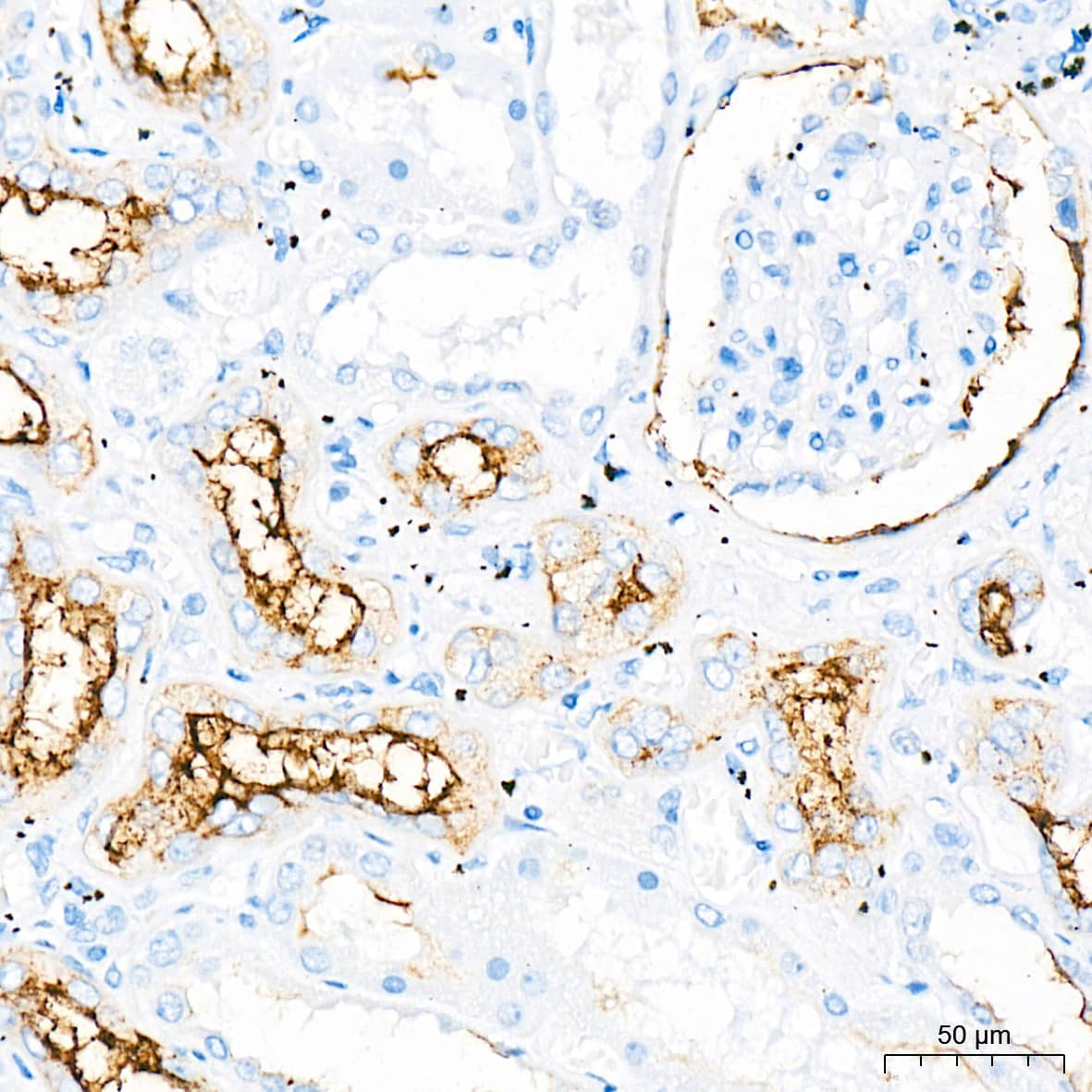 Immunohistochemistry: CD133 Antibody (3Y4A5) [CD133] - Immunohistochemistry analysis of paraffin-embedded Human kidney tissue using CD133 Rabbit mAb  at a dilution of 1:200 (40x lens). High pressure antigen retrieval was performed with 0.01 M citrate buffer (pH 6.0) prior to IHC staining.