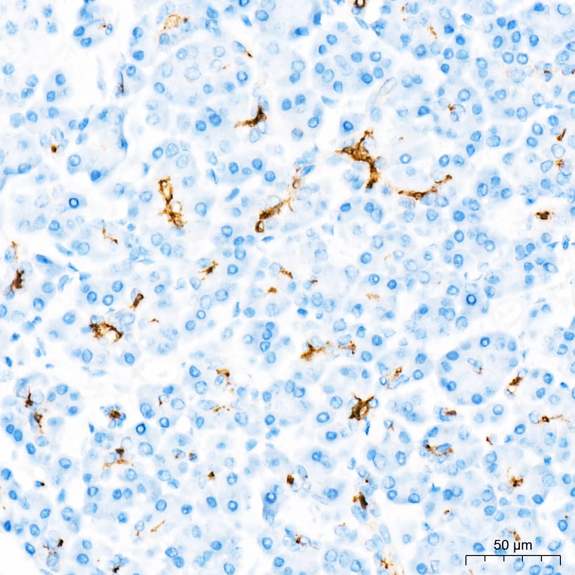 Immunohistochemistry: CD133 Antibody (3Y4A5) [CD133] - Immunohistochemistry analysis of paraffin-embedded Human pancreas tissue using CD133 Rabbit mAb  at a dilution of 1:200 (40x lens). High pressure antigen retrieval was performed with 0.01 M citrate buffer (pH 6.0) prior to IHC staining.