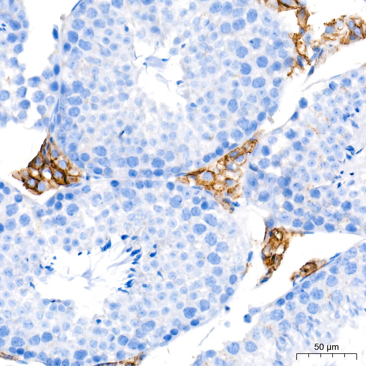 Immunohistochemistry: SR-BI Antibody (1C1I8) [SR-BI] - Immunohistochemistry analysis of paraffin-embedded Mouse testis tissue using SR-BI Rabbit mAb  at a dilution of 1:1000 (40x lens). High pressure antigen retrieval performed with 0.01M Tris-EDTA Buffer (pH 9.0) prior to IHC staining.