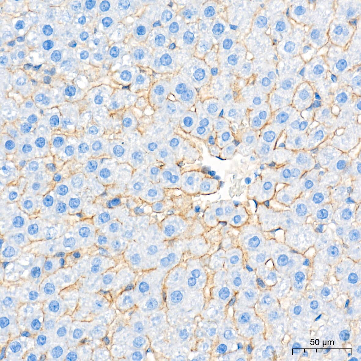 Immunohistochemistry: SR-BI Antibody (1C1I8) [SR-BI] - Immunohistochemistry analysis of paraffin-embedded Rat liver tissue using SR-BI Rabbit mAb  at a dilution of 1:1000 (40x lens). High pressure antigen retrieval performed with 0.01M Tris-EDTA Buffer (pH 9.0) prior to IHC staining.