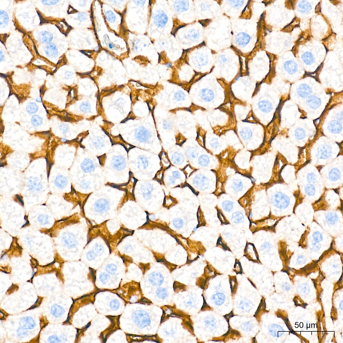 Immunohistochemistry: SR-BI Antibody (1C1I8) [SR-BI] - Immunohistochemistry analysis of paraffin-embedded Mouse liver tissue using SR-BI Rabbit mAb  at a dilution of 1:1000 (40x lens). High pressure antigen retrieval performed with 0.01M Tris-EDTA Buffer (pH 9.0) prior to IHC staining.