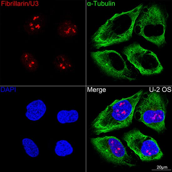 Immunocytochemistry/ Immunofluorescence: Fibrillarin Antibody (9J5O2) [Fibrillarin] - Confocal imaging of U-2OS cells using Fibrillarin Rabbit mAb    . The cells were counterstained with alpha-Tubulin Mouse mAb  (Green). DAPI was used for nuclear staining (blue). Objective: 60x.