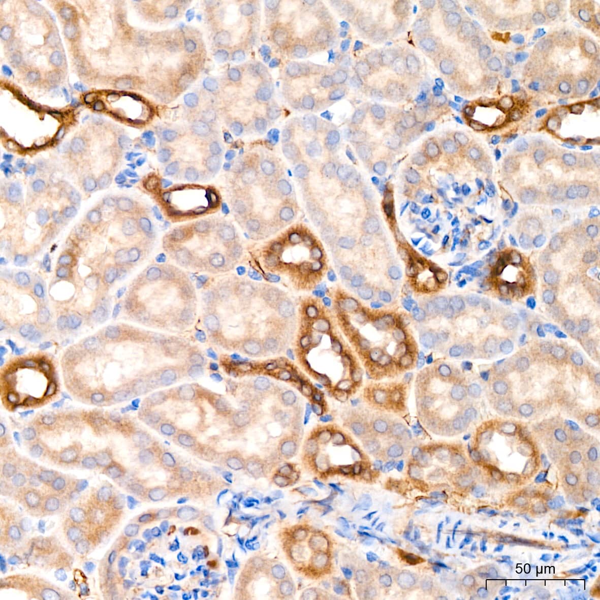 Immunohistochemistry: Microsomal Glutathione S-transferase 1 Antibody (6A0S5) [Microsomal Glutathione S-transferase 1] - Immunohistochemistry analysis of paraffin-embedded Mouse kidney tissue using Microsomal Glutathione S-transferase 1 Rabbit mAb  at a dilution of 1:200 (40x lens). High pressure antigen retrieval performed with 0.01M Citrate Bufferr (pH 6.0) prior to IHC staining.