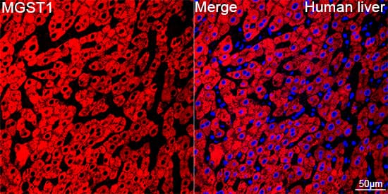 Immunocytochemistry/ Immunofluorescence: Microsomal Glutathione S-transferase 1 Antibody (6A0S5) [Microsomal Glutathione S-transferase 1] - Confocal imaging of paraffin-embedded Human liver using Microsomal Glutathione S-transferase 1 Rabbit mAb  followed by a further incubation with Cy3 Goat Anti-Rabbit IgG (H+L)  . DAPI was used for nuclear staining (Blue). Objective: 40x. Perform high pressure antigen retrieval with 0.01 M citrate buffer (pH 6.0) prior to IF staining.