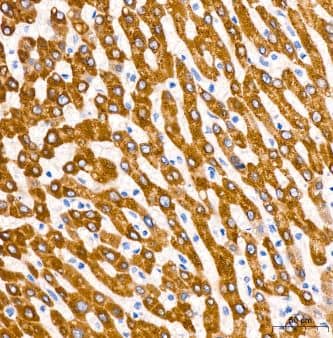 Immunohistochemistry-Paraffin: Microsomal Glutathione S-transferase 1 Antibody (6A0S5) [NBP3-15316] - Human liver tissue using MGST1 Rabbit mAb at a dilution of 1:200 (40x lens). High pressure antigen retrieval performed with 0.01M Citrate Bufferr (pH 6.0) prior to IHC staining.