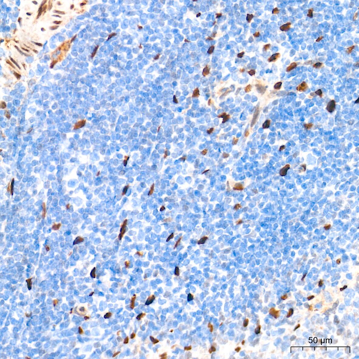 Immunohistochemistry: HES-1 Antibody (9I2E8) [HES-1] - Immunohistochemistry analysis of paraffin-embedded Rat spleen tissue using HES-1 Rabbit mAb  at a dilution of 1:2000 (40x lens). High pressure antigen retrieval performed with 0.01M Tris-EDTA Buffer (pH 9.0) prior to IHC staining.