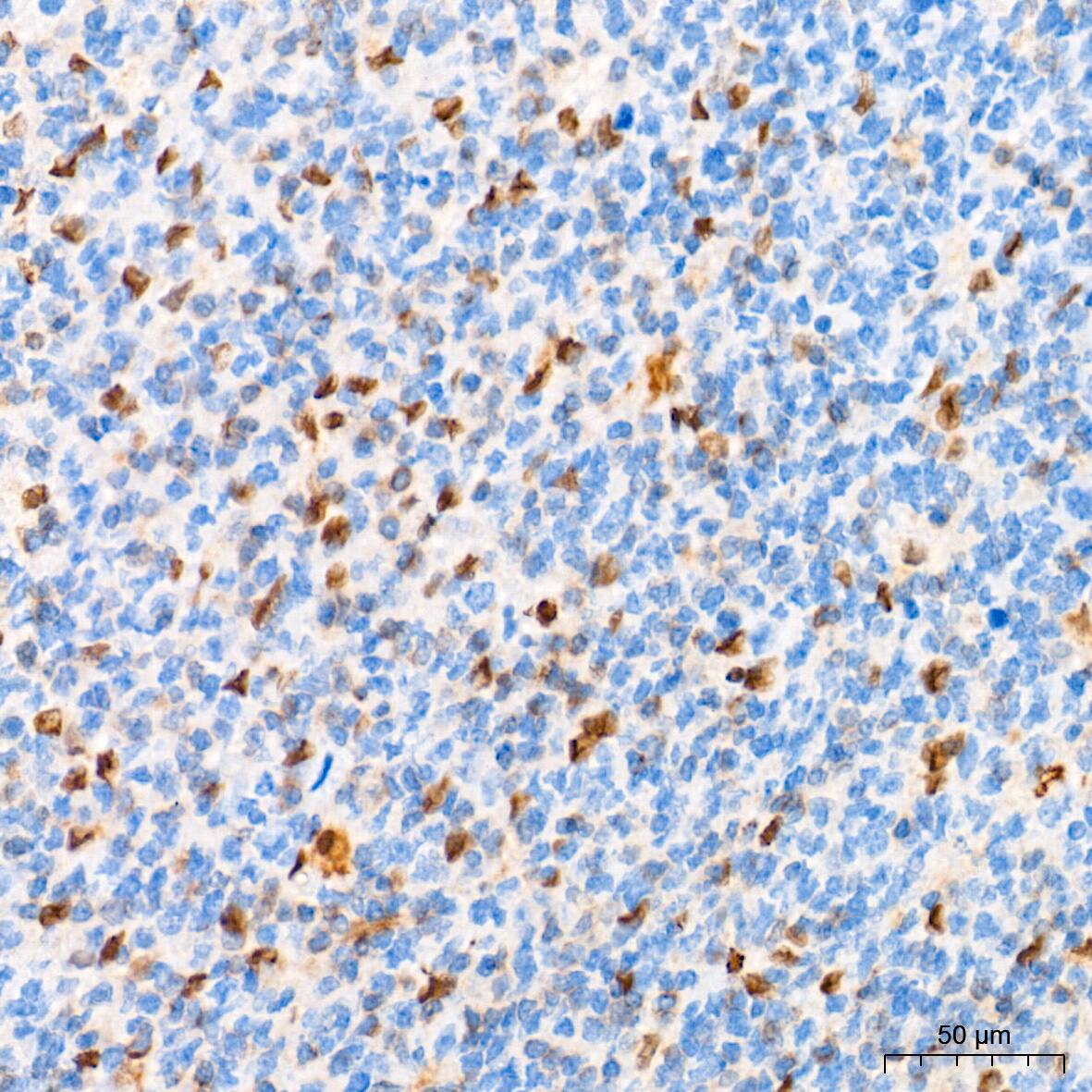 Immunohistochemistry: HES-1 Antibody (9I2E8) [HES-1] - Immunohistochemistry analysis of paraffin-embedded Human tonsil tissue using HES-1 Rabbit mAb  at a dilution of 1:2000 (40x lens). High pressure antigen retrieval performed with 0.01M Tris-EDTA Buffer (pH 9.0) prior to IHC staining.