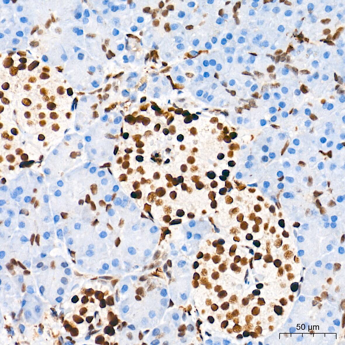 Immunohistochemistry: HES-1 Antibody (9I2E8) [HES-1] - Immunohistochemistry analysis of paraffin-embedded Human pancreas tissue using HES-1 Rabbit mAb  at a dilution of 1:2000 (40x lens). High pressure antigen retrieval performed with 0.01M Tris-EDTA Buffer (pH 9.0) prior to IHC staining.