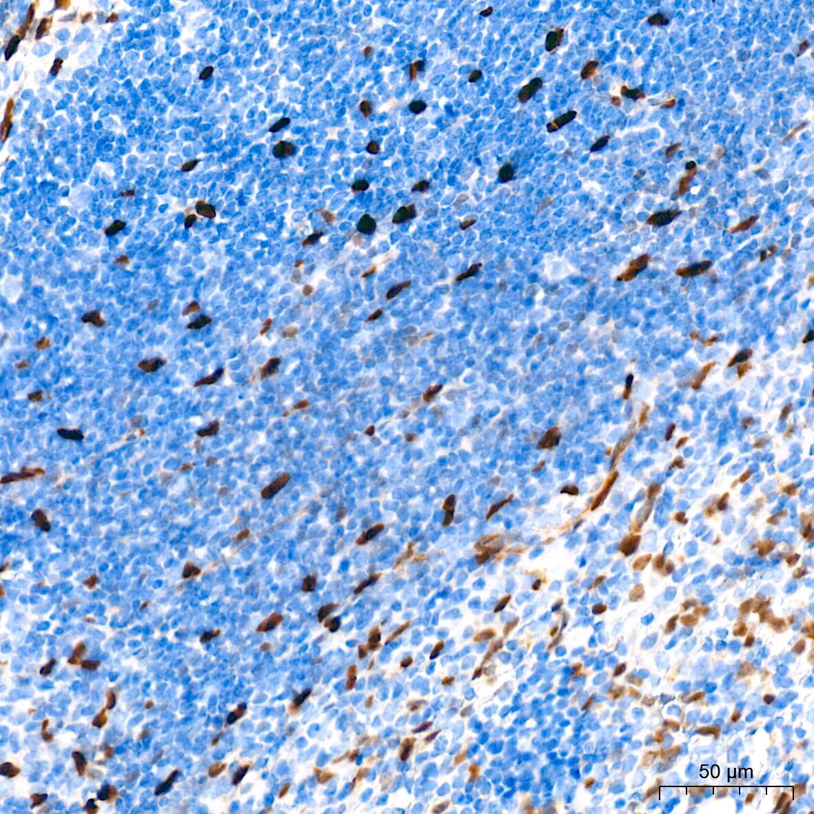 Immunohistochemistry: HES-1 Antibody (9I2E8) [HES-1] - Immunohistochemistry analysis of paraffin-embedded Mouse spleen tissue using HES-1 Rabbit mAb  at a dilution of 1:2000 (40x lens). High pressure antigen retrieval performed with 0.01M Tris-EDTA Buffer (pH 9.0) prior to IHC staining.