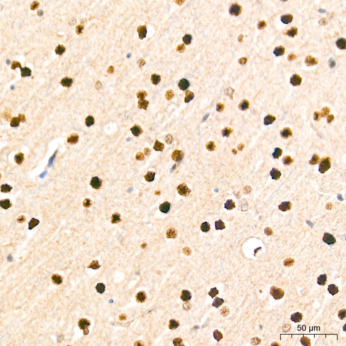 Immunohistochemistry: HES-1 Antibody (9I2E8) [HES-1] - Immunohistochemistry analysis of paraffin-embedded Rat brain tissue using HES-1 Rabbit mAb  at a dilution of 1:2000 (40x lens). High pressure antigen retrieval performed with 0.01M Tris-EDTA Buffer (pH 9.0) prior to IHC staining.